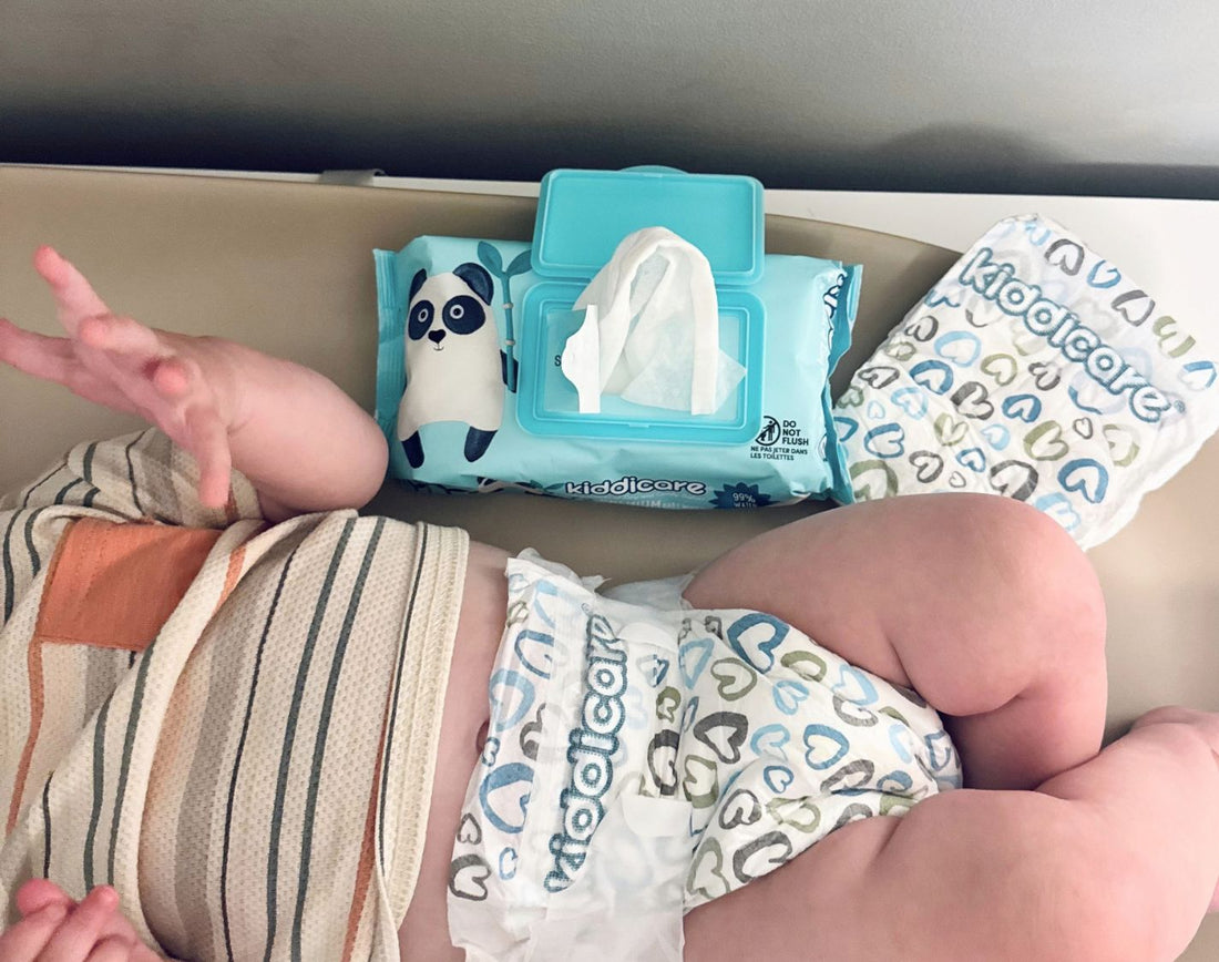 Diaper Rash Prevention: 5 Simple Tips for Happy, Healthy Baby Skin
